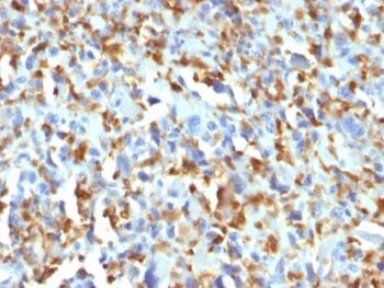 Factor XIIIa (Coagulation Factor XIIIA Chain) (F13A1/1683), Biotin conjugate, 0.1mg/mL