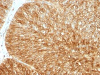 Beta-2 Microglobulin (Renal Failure & Tumor Marker) (B2M/1857R), BSA-free, 1 mg/mL