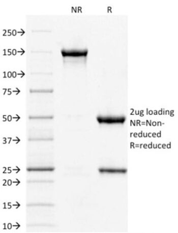 STAT3 / Signal Transducer and Activator of Transcription 3 (PCRP-STAT3-2F12), CF405S conjugate, 0.1mg/mL