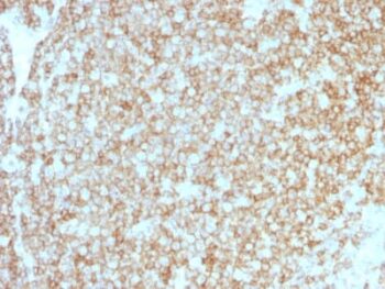 CD45 / LCA (Leucocyte Marker) (PTPRC/1783R + PTPRC/1975R), 0.2mg/mL
