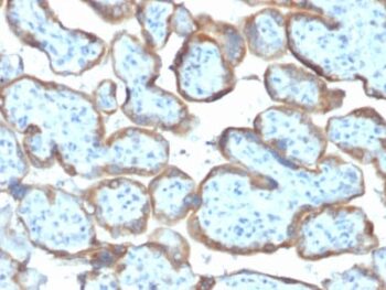 TIMP2 (Tissue Inhibitor of Metalloproteinase 2) (TIMP2/2044), CF594 conjugate, 0.1mg/mL