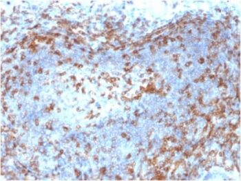 ZAP70 (Chronic Lymphocytic Leukemia Marker) (ZAP70/2046), CF568 conjugate, 0.1mg/mL