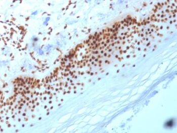 Nucleophosmin (Acute Myeloid Leukemia Marker) (NA24), CF568 conjugate, 0.1mg/mL