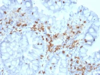 CD103 / Integrin alpha E (T-Cell Lymphoma & Hairy Cell Leukemia Marker) (ITGAE/2063), 0.2mg/mL