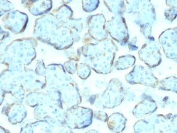 Superoxide Dismutase 1 (SOD1) (Antioxidant Enzyme) (SOD1/2089), 0.2mg/mL