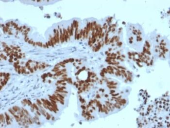 p53 Tumor Suppressor Protein (TP53/2092R), CF594 conjugate, 0.1mg/mL