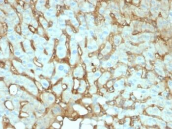 Albumin (Transport Protein) (ALB/2144), 0.2mg/mL