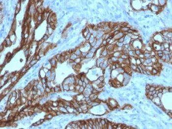 TACSTD2 / TROP2 (Epithelial Marker) (TACSTD2/2152), CF647 conjugate, 0.1mg/mL