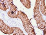 Ep-CAM / CD326 (Extracellular Domain) (Epithelial Marker) (rEGP40/1372), CF405S conjugate, 0.1mg/mL