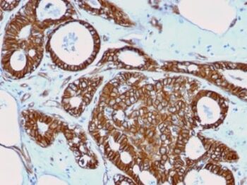 Catenin, beta (CTNNB1) (rCTNNB1/2173), CF405S conjugate, 0.1mg/mL
