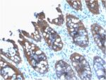 Cytokeratin 8 (KRT8) (rB22.1), CF568 conjugate, 0.1mg/mL 1 BNUB2175