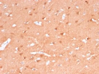PGP9.5 / UchL1 (pan-Neuronal Marker) (rUCHL1/775), CF488A conjugate, 0.1mg/mL