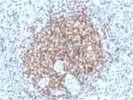 Bcl-2 (Apoptosis & Follicular Lymphoma Marker) (BCL2/2210R), CF740 conjugate, 0.1mg/mL