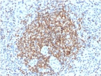 Bcl-2 (Apoptosis & Follicular Lymphoma Marker) (BCL2/2210R), CF740 conjugate, 0.1mg/mL