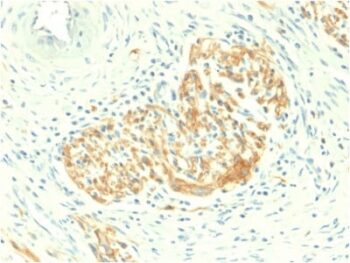 CD56 / NCAM1 / NKH1 (Neuronal Cell Marker) (NCAM1/2217R), CF405S conjugate, 0.1mg/mL