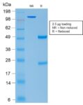 ACTH (Adrenocorticotrophic Hormone) (Pituitary Marker) (rCLIP/1407), CF488A conjugate, 0.1mg/mL