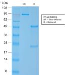 Smooth Muscle Myosin Heavy Chain (SM-MHC) (MYH11/2303R), CF647 conjugate, 0.1mg/mL