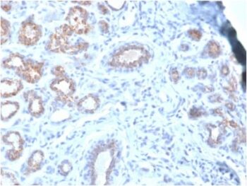 HSP27 (Heat Shock Protein 27) (rHSPB1/774), 0.2mg/mL