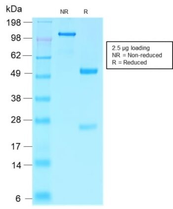 Villin (GI-Mucosal & Urogenital Brush Border Marker) (VIL1/2310R), CF740 conjugate, 0.1mg/mL