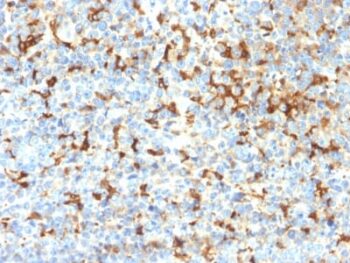 Tyrosinase-Related Protein-1 (TYRP-1) (Melanoma Marker) (TYRP1/2340R), CF405S conjugate, 0.1mg/mL