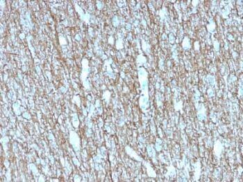 Neurofilament (NF-H) (Neuronal Marker) (rNF421), CF568 conjugate, 0.1mg/mL