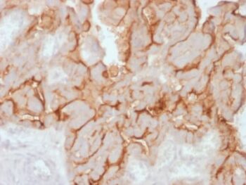 MUC16 / CA125 (Ovarian Carcinoma Marker) (OCA125/2349R), CF640R conjugate, 0.1mg/mL