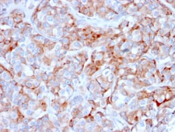 CD269 / TNFRSF17 / BCMA (B-Cell Maturation Protein) (BCMA/2366), 0.2mg/mL