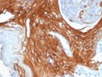 Cytokeratin 6A (KRT6A) (Basal Cell Marker) (KRT6A/2368), CF488A conjugate, 0.1mg/mL