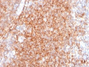 CD40 / TNFRSF5 / CD40L-Receptor (C40/2383), 0.2mg/mL