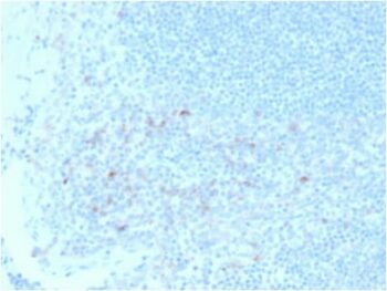 CD25/ IL2RA (Activated Lymphocyte Marker) (IL2RA/2395), 0.2mg/mL