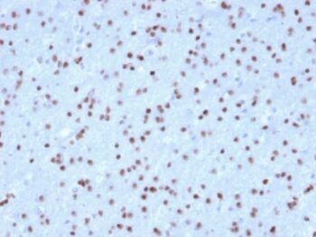 OLIG2 (Marker of Glial Brain Tumors) (OLIG2/2400), CF543 conjugate, 0.1mg/mL