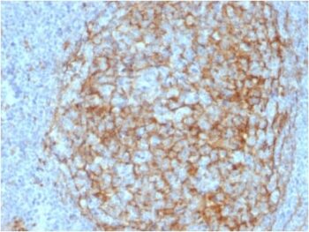 CD14 (Monocyte / Macrophage Marker) (LPSR/2408), 0.2mg/mL