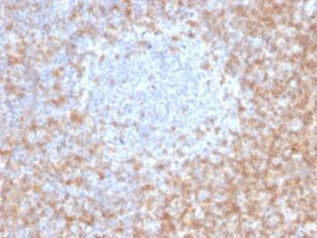 CD5 (Mantle Cell Lymphoma Marker) (CD5/2416), 0.2mg/mL
