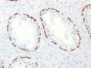 p63 (Squamous, Basal & Myoepithelial Cell Marker) (TP63/2427), Biotin conjugate, 0.1mg/mL
