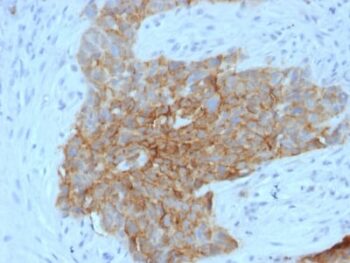 GLUT-1 (Tumor Progression and Mesothelioma Marker) (GLUT1/2475), CF568 conjugate, 0.1mg/mL