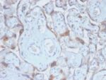 TIMP2 (Tissue Inhibitor of Metalloproteinase 2) (TIMP2/2488R), CF568 conjugate, 0.1mg/mL