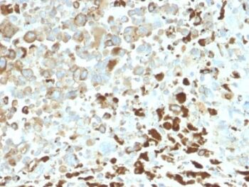 NGF-Receptor (p75) / CD271 (Soft Tissue Tumor Marker) (NGFR/2550R), CF488A conjugate, 0.1mg/mL