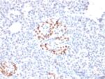 BNUB2561