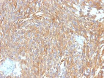 DOG-1 / TMEM16A (Gastrointestinal Stromal Tumor Marker) (DG1/2564R), CF647 conjugate, 0.1mg/mL
