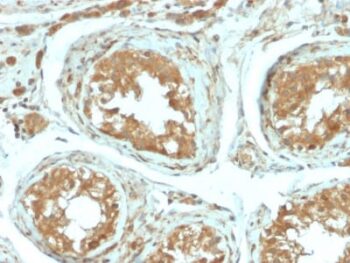 B7-H4 (Immuno-Inhibitory Protein) (B7H4/2652R), 0.2mg/mL