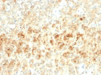 Adipophilin / Perilipin-2 (Marker of Lipid Accumulation) (ADFP/2755R), 0.2mg/mL