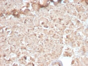 CELA3B / ELA3B (Pancreatic Function Marker) (CELA3B/2810R), CF568 conjugate, 0.1mg/mL