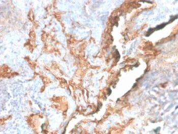 Tenascin C (Stromal Marker For Epithelial Malignancy) (TNC/2981R), CF568 conjugate, 0.1mg/mL