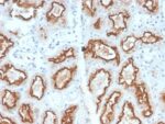 Renal Cell Carcinoma (Carbonic Anhydrase IX) (CA9/2993R), CF740 conjugate, 0.1mg/mL