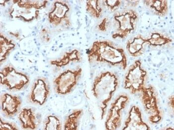 Renal Cell Carcinoma (Carbonic Anhydrase IX) (CA9/2993R), CF740 conjugate, 0.1mg/mL