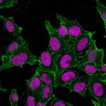 CD44-DF1485-CF488A-PFA-HeLa-3ug-mL-RedDot2