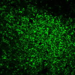 CD45RO-UCHL1-tonsil-CF488A-tyramide-amplification-buffer-plus