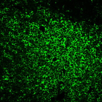CD45RO(UCHL-1), 0.2mg/mL
