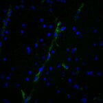 CF488A-vWF-3E2D10-brain