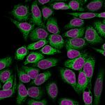 Calnexin-1541-CF488A-PFA-HeLa-3ug-mL-RedDot2